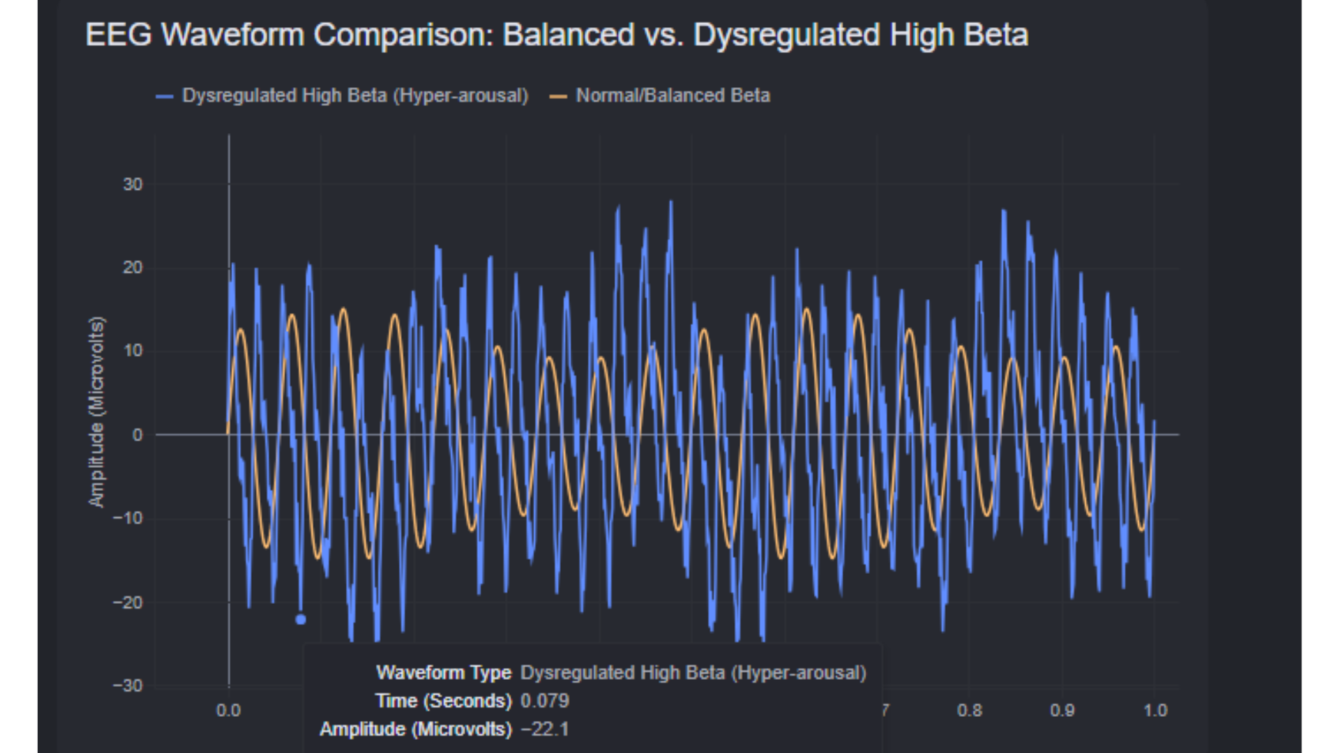 beta waves